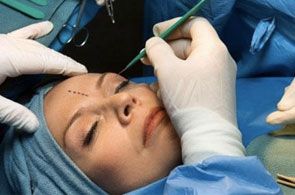 chirurgie esthetique 10 6