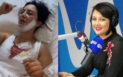 Agression à l’arme blanche de l’animatrice radio Sahar Hamed, lors d’un braquage  : Les suspects arrêtés