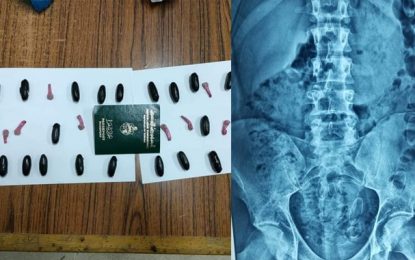 Cité Ennasr : Rentré récemment de Turquie, un individu arrêté avec des capsules d’héroïne dans l’estomac