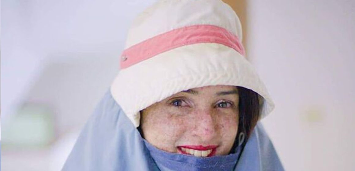 التونسية لمياء حكيم أول امرأة في العالم من أطفال القمر تناقش رسالة الدكتوراه