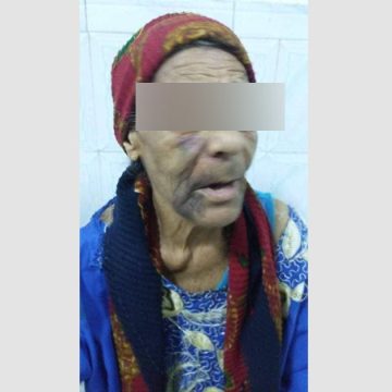 بلاغ وزاري حول خبر يوثق اعتداء على مسنة  (83 سنة) من طرف ابنها (53 سنة)