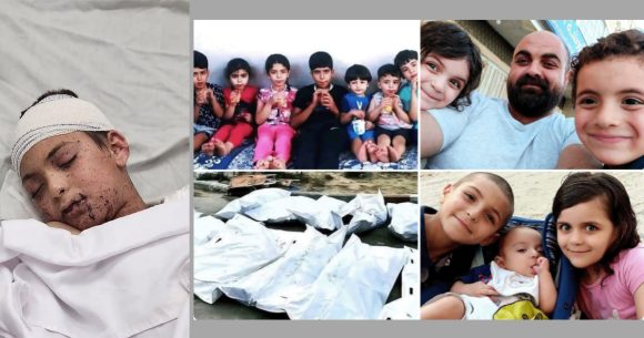 الكرباعي: الطفل الفلسطيني آدم النجار يتلقى العلاج بميلانو