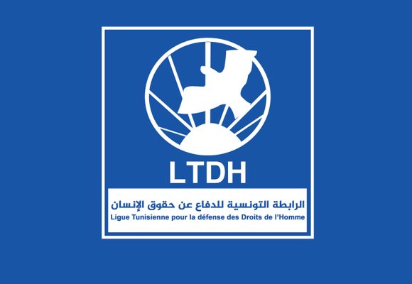 رابطة الدفاع عن حقوق الانسان تعاين حالة تعذيب لمواطن بمركز الأمن