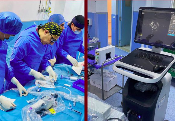 في مستشفى شارل نيكول بالعاصمة: أوّل علاج لتكلّسات الشرايين بالموجات التصادمية