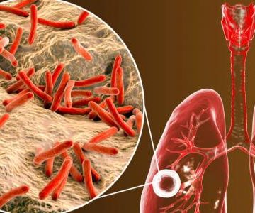 مرض السل ملتقى علمي بأريانة تحت شعار: مالجديد في مرض السل لسنة 2026؟