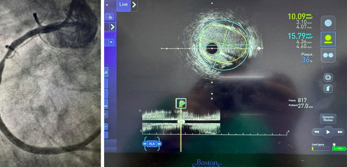 تونس: المستشفيات العموميّة تتميّز إفريقيّا في الابتكار الطبي