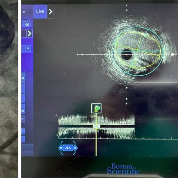 تونس: المستشفيات العموميّة تتميّز إفريقيّا في الابتكار الطبي