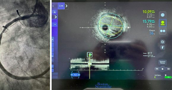 تونس: المستشفيات العموميّة تتميّز إفريقيّا في الابتكار الطبي
