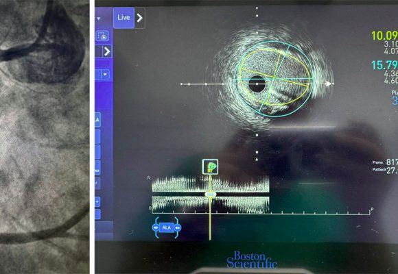 تونس: المستشفيات العموميّة تتميّز إفريقيّا في الابتكار الطبي