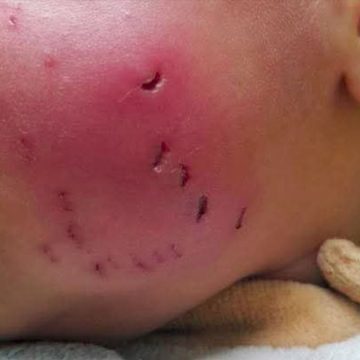 الأوضاع البيئية و الصحية في قطاع غزة: تفشي الأوبئة نتيجة انتشار القوارض