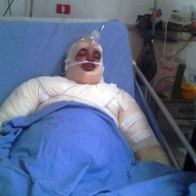 Mehdi-Ouji-sur-son-lit-hopital