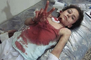 Hopital-Gaza