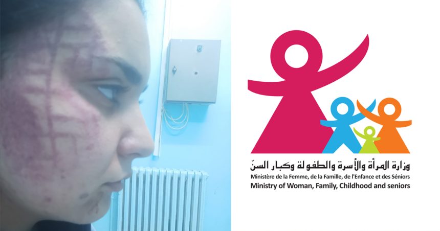 Du nouveau dans l’affaire de Rihab, violemment agressée par son frère à Médenine (Ministère de la Femme)