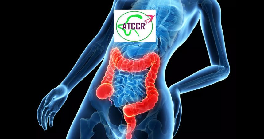Le cancer colorectal enregistre plus de 2200 nouveaux cas chaque année en Tunisie