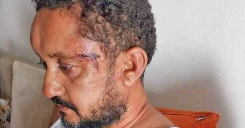 Tunisie : le SNJT condamne l’agression policière du journaliste Sofien Ben Nejima