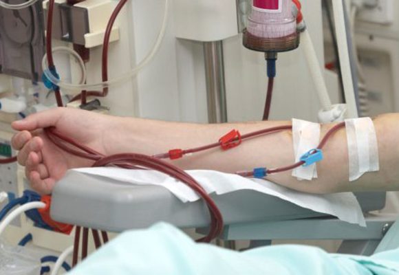 La Tunisie compte 12 000 patients dialysés