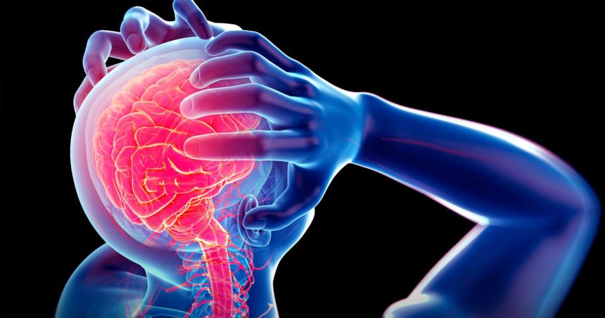Santé : Hygiène dentaire et accidents vasculaires cérébraux