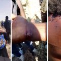 HRW dénonce de «graves abus» contre des migrants africains noirs en Tunisie    