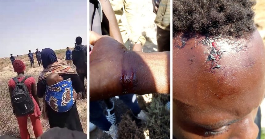 HRW dénonce de «graves abus» contre des migrants africains noirs en Tunisie    
