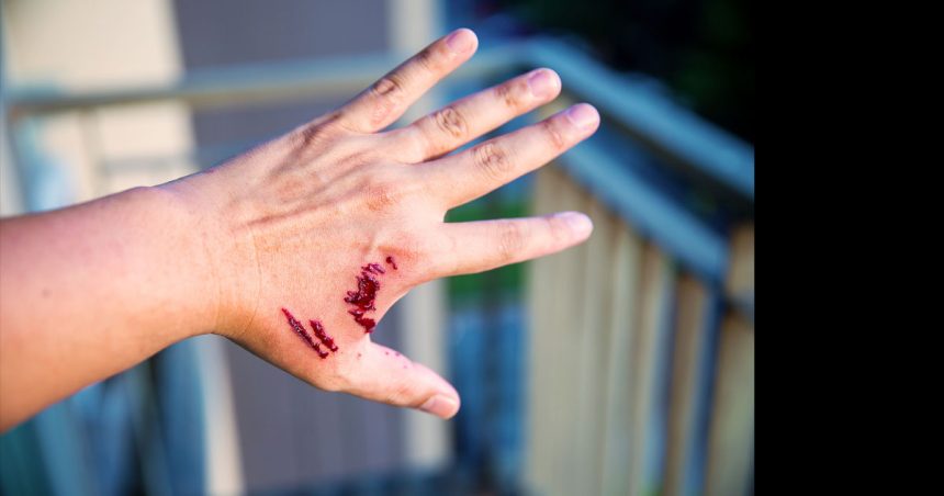 Tunisie : un enfant meurt de la rage, le 5e depuis le début de l’année