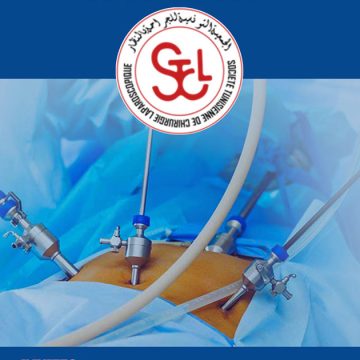 Congrès à Tunis sur les innovations dans le domaine de la chirurgie laparoscopique