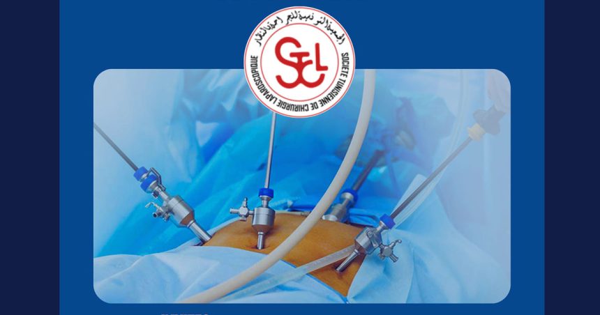 Congrès à Tunis sur les innovations dans le domaine de la chirurgie laparoscopique