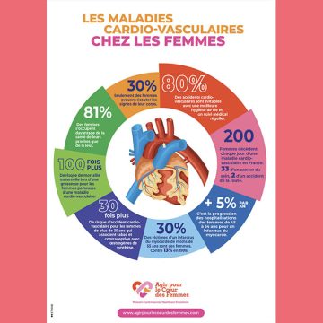 Le tabagisme, 1er facteur de risque de l’infarctus du myocarde chez la femme