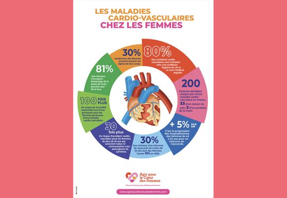 Le tabagisme, 1er facteur de risque de l’infarctus du myocarde chez la femme