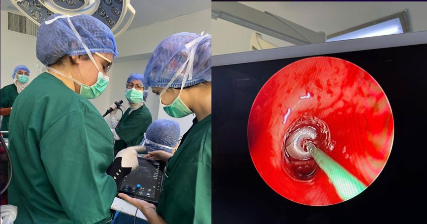 Tunisie | Cryobiopsie pulmonaire et cryo-debulking à l’hôpital A. Mami
