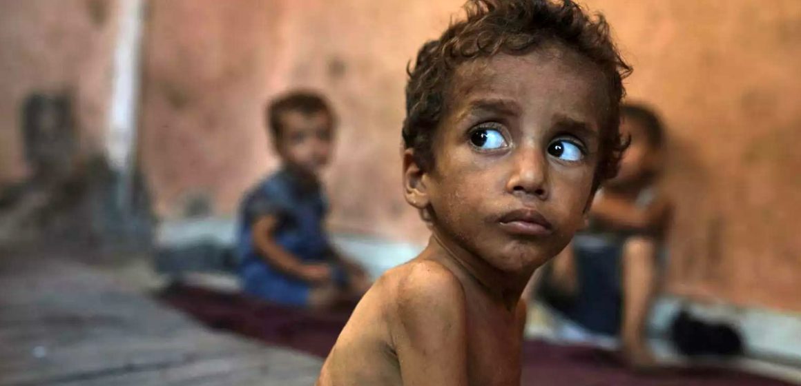 Unicef | 12 000 enfants gravement malnutris à Gaza