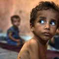 Unicef | 12 000 enfants gravement malnutris à Gaza