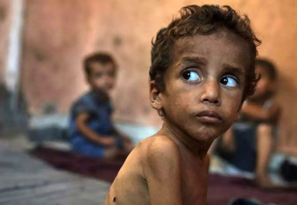 Unicef | 12 000 enfants gravement malnutris à Gaza