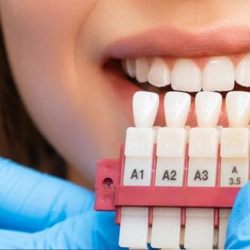 Non au blanchiment dentaire en dehors des cabinets médicaux