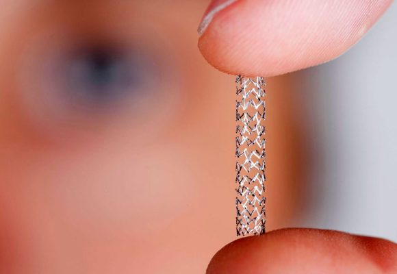Santé | Introduction des stents résorbables en Tunisie